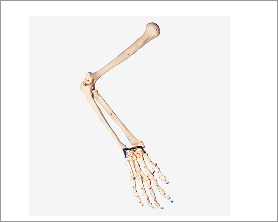Arm Bone Model