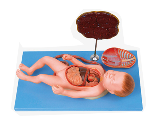 Fetus with Viscus and Placenta