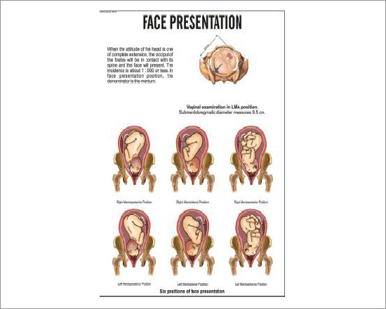 Face Presentation Chart
