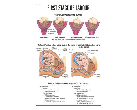 first Stage of labour Chart