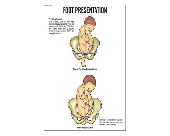 Foot Presentation Chart