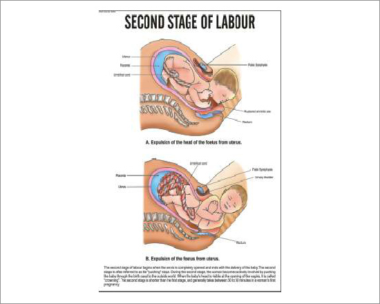 Second Stage of labour Chart